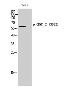 CRMP-2 (phospho Ser522) Rabbit Polyclonal Antibody