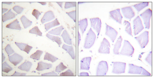 Crystallin-αB (phospho Ser19) Rabbit Polyclonal Antibody