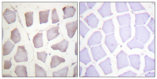Crystallin-αB (phospho Ser59) Rabbit Polyclonal Antibody
