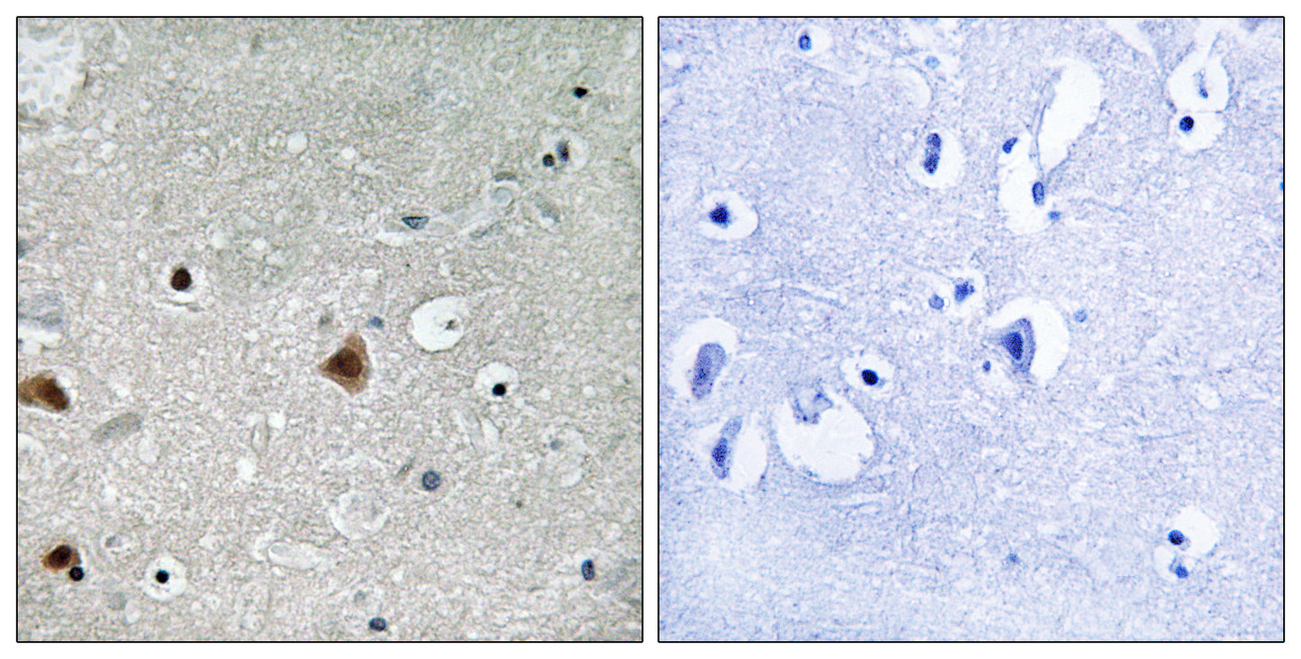 CSN1 (phospho Ser454) Rabbit Polyclonal Antibody