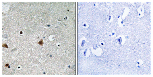 CSN1 (phospho Ser454) Rabbit Polyclonal Antibody