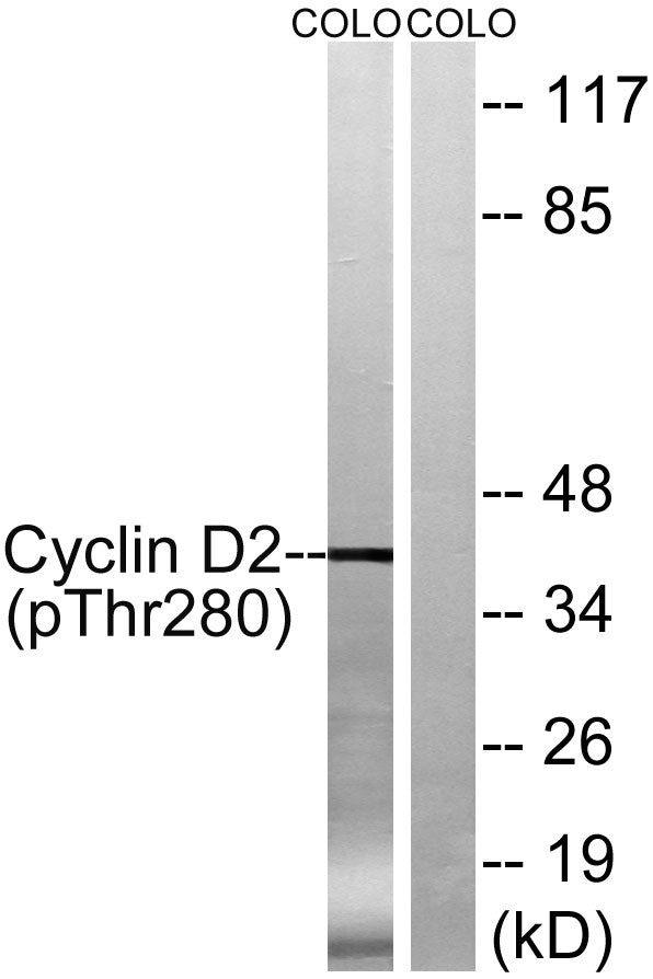 Cyclin D2 (phospho Thr280) Rabbit Polyclonal Antibody