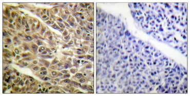 DAPK1 (phospho Ser308) Rabbit Polyclonal Antibody