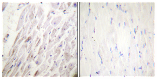 Dematin (phospho Ser403) Rabbit Polyclonal Antibody