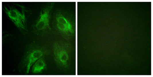 DREAM (phospho Ser63) Rabbit Polyclonal Antibody