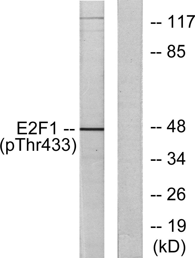 E2F-1 (phospho Thr433) Rabbit Polyclonal Antibody