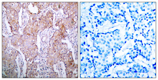EGFR (phospho Ser1070) Rabbit Polyclonal Antibody