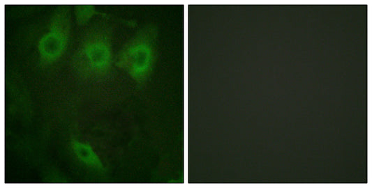 EGFR (phospho Tyr1016) Rabbit Polyclonal Antibody