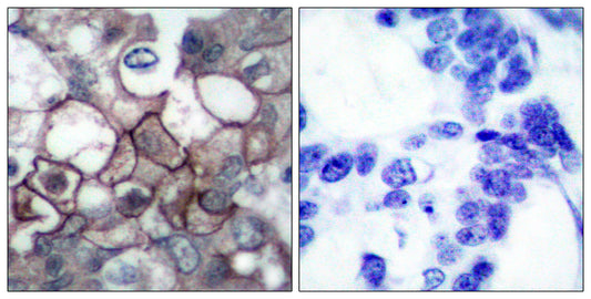 EGFR (phospho Tyr1197) Rabbit Polyclonal Antibody
