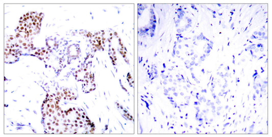 Elk-1 (phospho Ser389) Rabbit Polyclonal Antibody