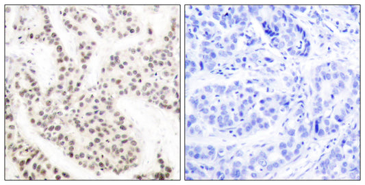 Elk-1 (phospho Thr417) Rabbit Polyclonal Antibody