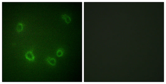 ENaC β (phospho Thr615) Rabbit Polyclonal Antibody