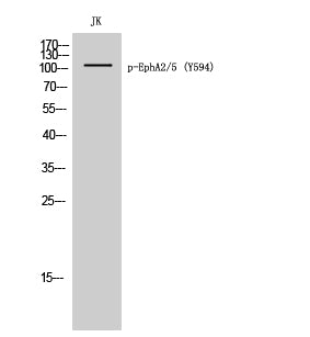 EphA2/5 (phospho Tyr594) Rabbit Polyclonal Antibody
