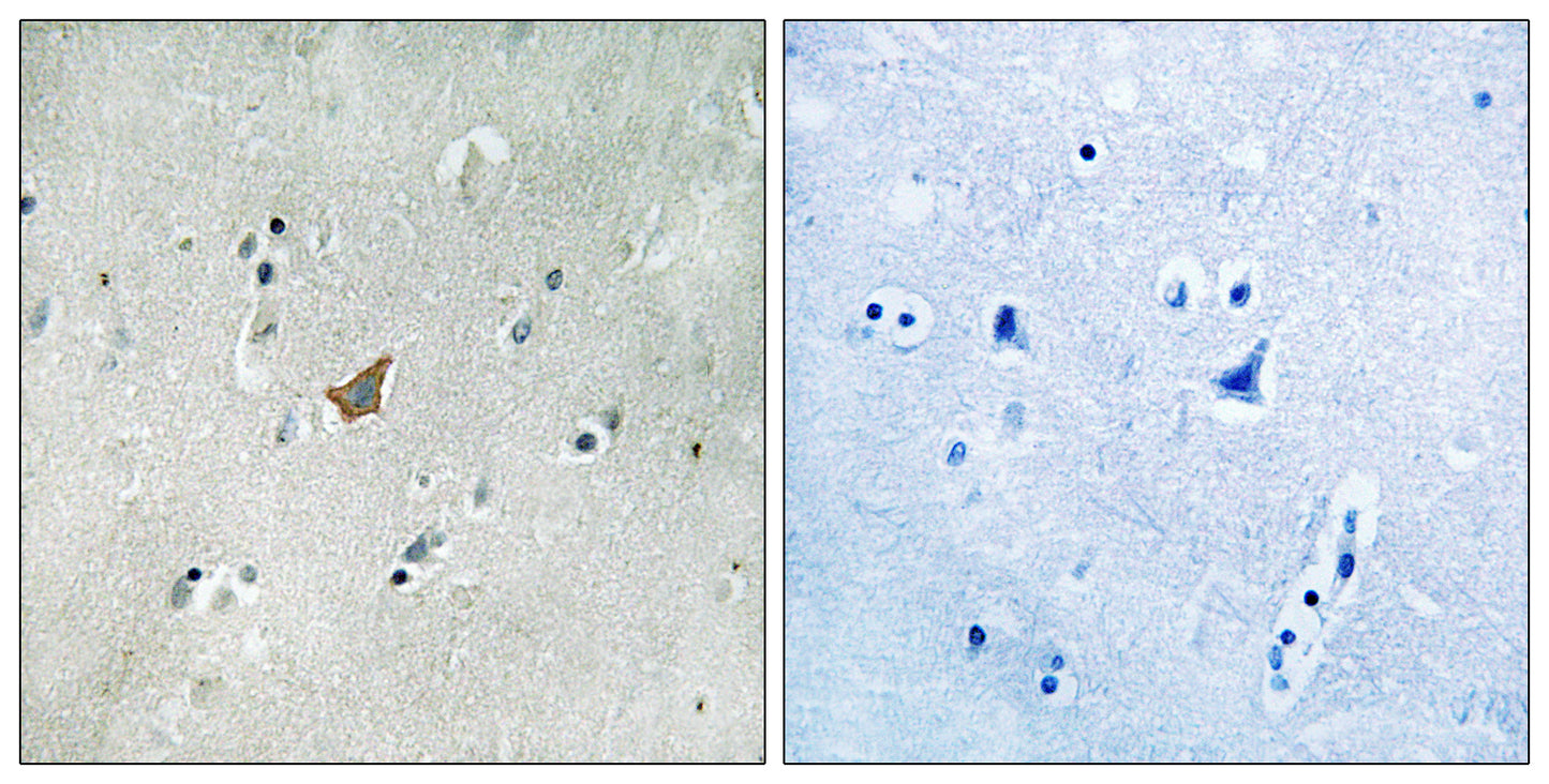 EphA3/4/5 (phospho Tyr779/833) Rabbit Polyclonal Antibody
