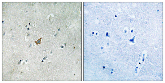 EphA3/4/5 (phospho Tyr779/833) Rabbit Polyclonal Antibody