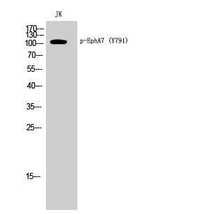 EphA7 (phospho Tyr791) Rabbit Polyclonal Antibody
