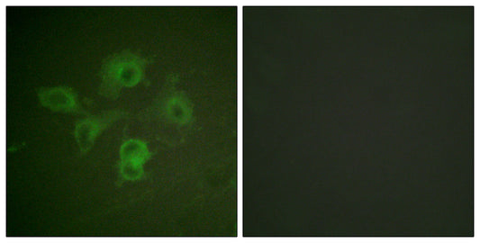 EphB1/2 (phospho Tyr594/604) Rabbit Polyclonal Antibody