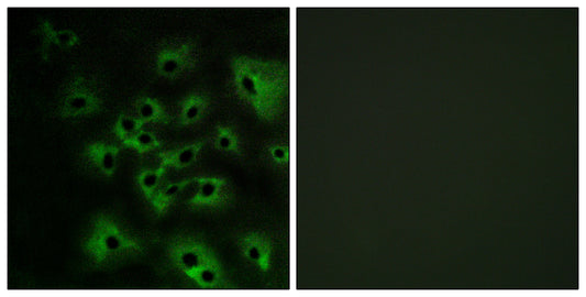 ErbB-4 (phospho Tyr1284) Rabbit Polyclonal Antibody