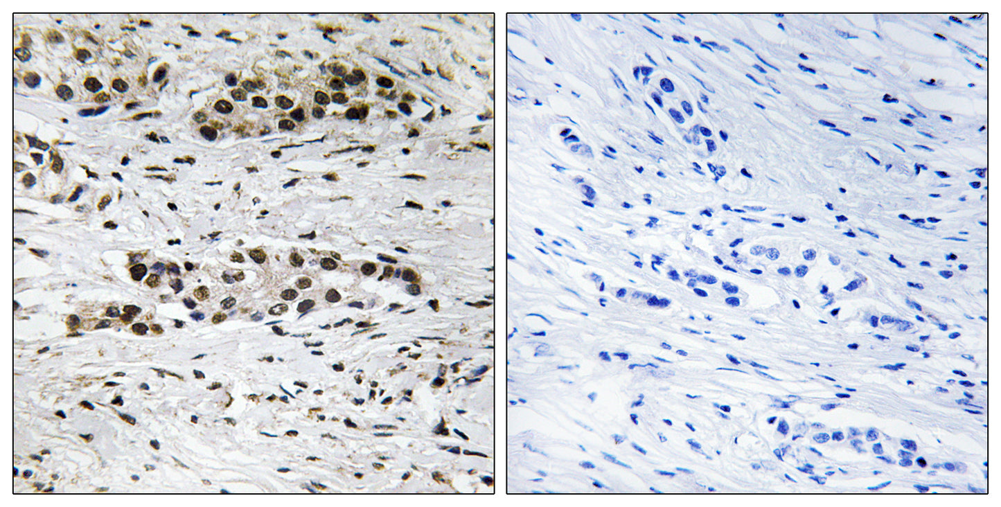 ERα (phospho Ser102) Rabbit Polyclonal Antibody