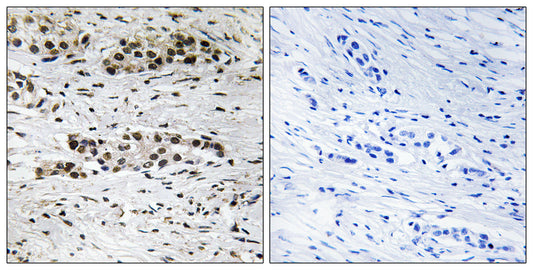 ERα (phospho Ser102) Rabbit Polyclonal Antibody