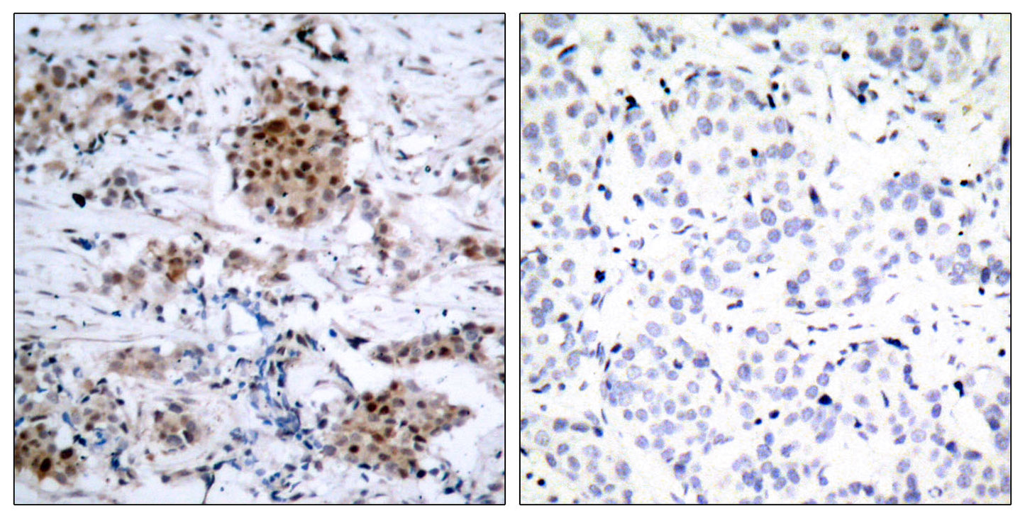 ERα (phospho Ser167) Rabbit Polyclonal Antibody