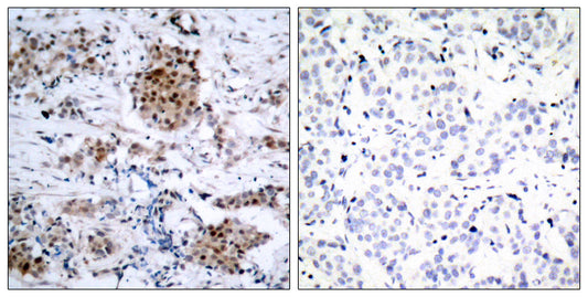 ERα (phospho Ser167) Rabbit Polyclonal Antibody