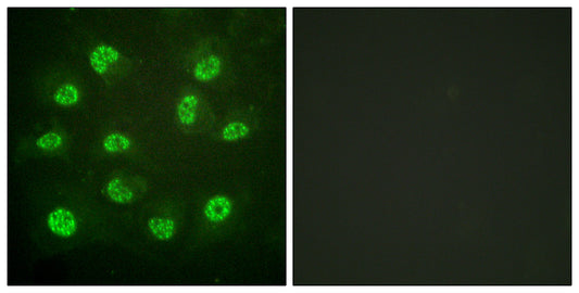 ERβ (phospho Ser105) Rabbit Polyclonal Antibody