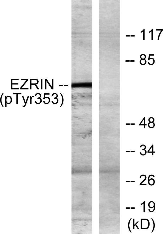Ezrin (phospho Tyr353) Rabbit Polyclonal Antibody