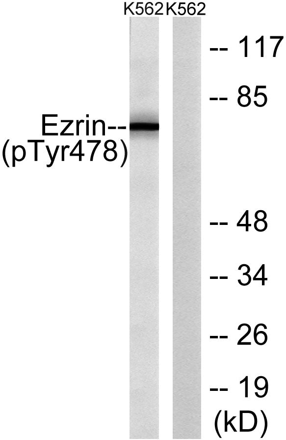 Ezrin (phospho Tyr478) Rabbit Polyclonal Antibody