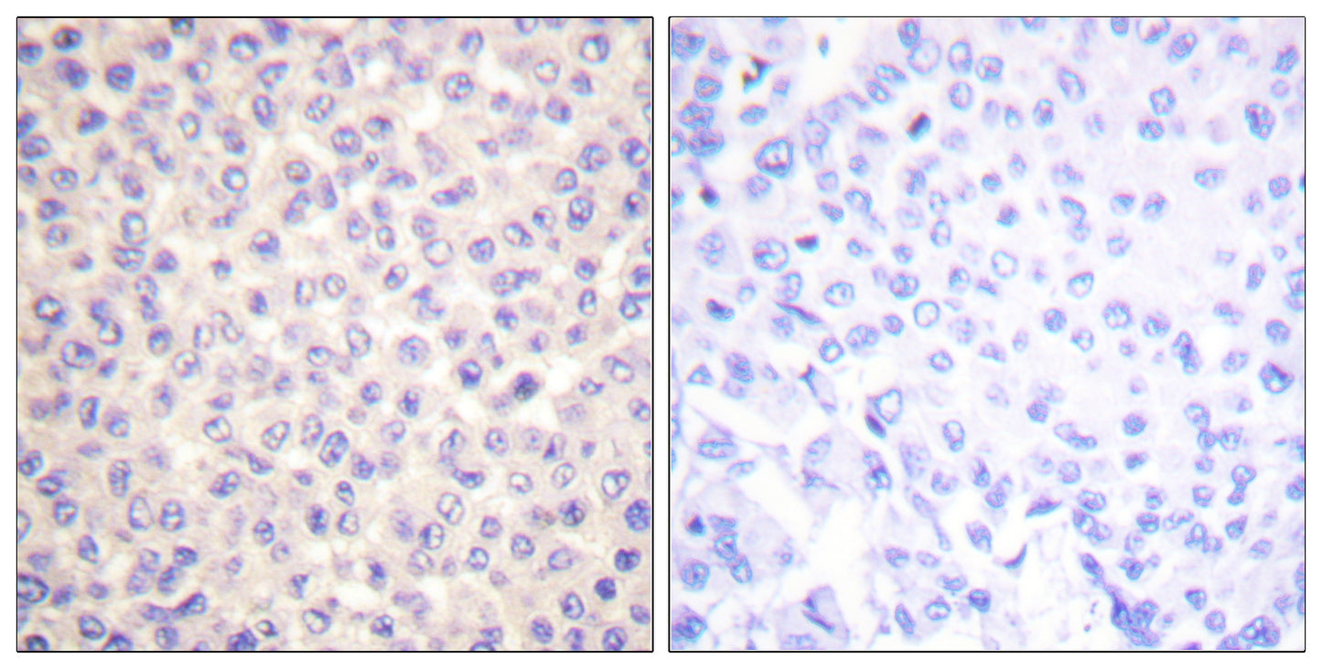 FADD (phospho Ser194) Rabbit Polyclonal Antibody