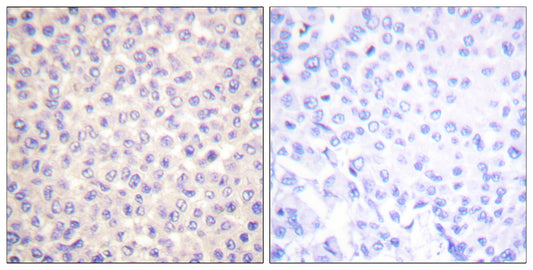 FADD (phospho Ser194) Rabbit Polyclonal Antibody