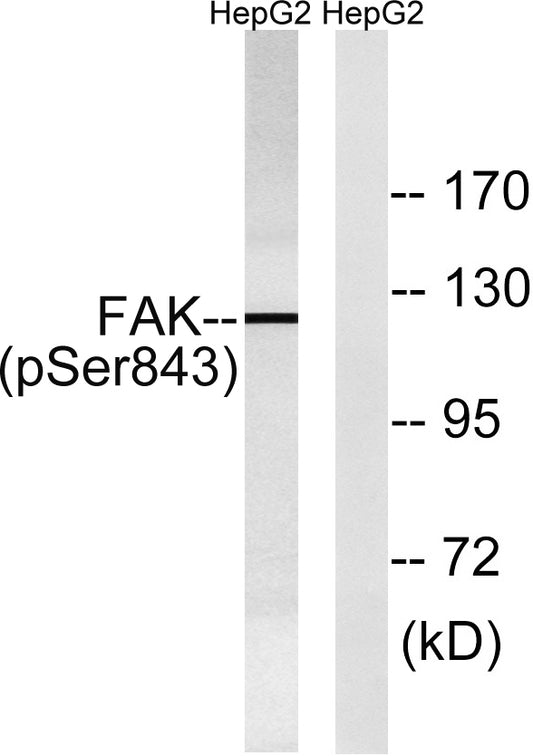 FAK (phospho Ser843) Rabbit Polyclonal Antibody