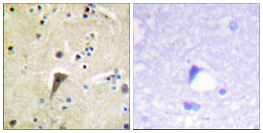 FAK (phospho Tyr397) Rabbit Polyclonal Antibody