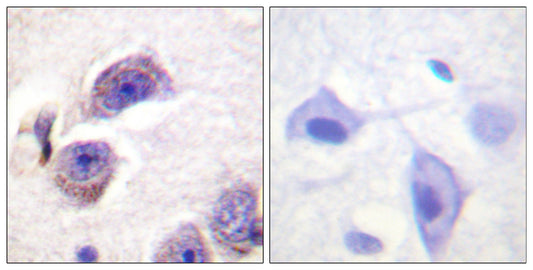 FAK (phospho Tyr407) Rabbit Polyclonal Antibody