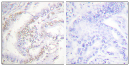 FANCD2 (phospho Ser222) Rabbit Polyclonal Antibody