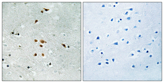 Fer (phospho Tyr402) Rabbit Polyclonal Antibody