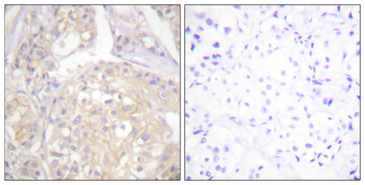 Flg (phospho Tyr766) Rabbit Polyclonal Antibody