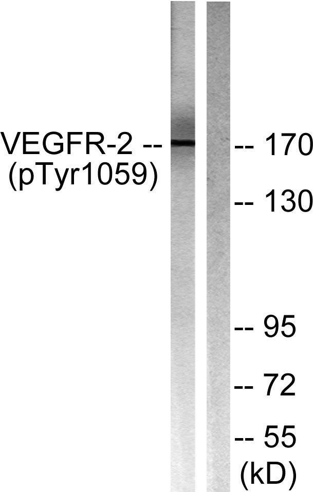 Flk-1 (phospho Tyr1059) Rabbit Polyclonal Antibody