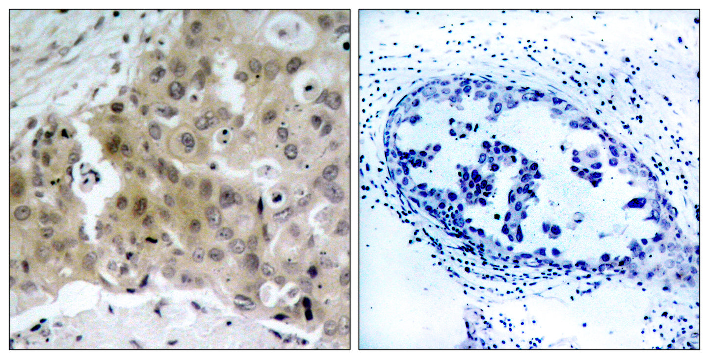 Flk-1 (phospho Tyr1175) Rabbit Polyclonal Antibody