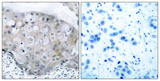 Flk-1 (phospho Tyr951) Rabbit Polyclonal Antibody