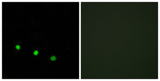 Fos B (phospho Ser27) Rabbit Polyclonal Antibody