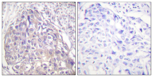FoxO1/3/4 (phospho Thr24/32) Rabbit Polyclonal Antibody
