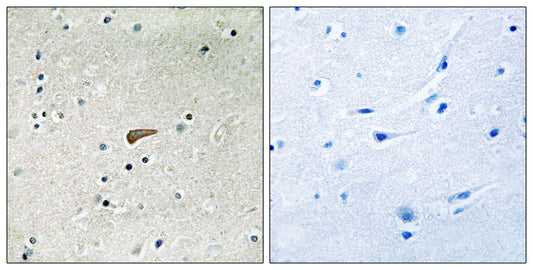 FRS2 (phospho Tyr436) Rabbit Polyclonal Antibody