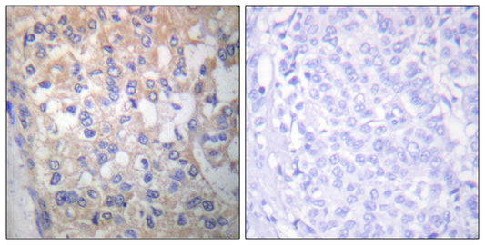 Fyn (phospho Tyr530) Rabbit Polyclonal Antibody