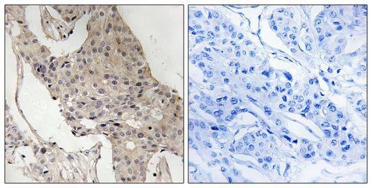 Gab 2 (phospho Ser623) Rabbit Polyclonal Antibody