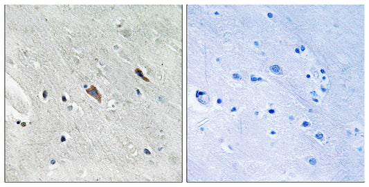 Gab 2 (phospho Tyr643) Rabbit Polyclonal Antibody