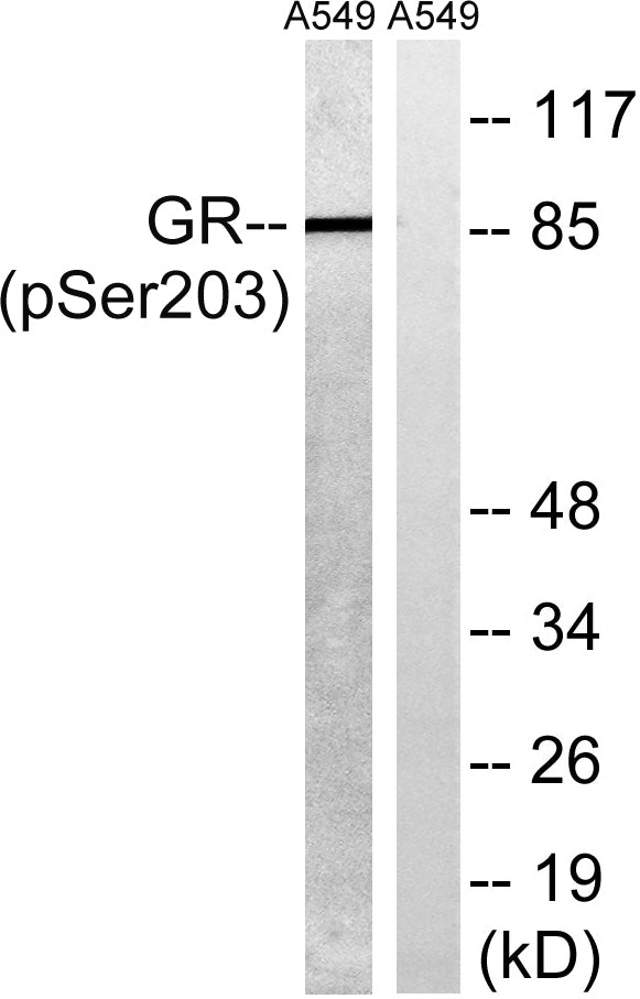 GR (phospho Ser203) Rabbit Polyclonal Antibody