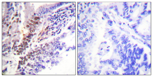 GR (phospho Ser226) Rabbit Polyclonal Antibody