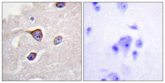 GRK 1 (phospho Ser21) Rabbit Polyclonal Antibody
