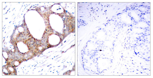 GSK3α (phospho Ser21) Rabbit Polyclonal Antibody